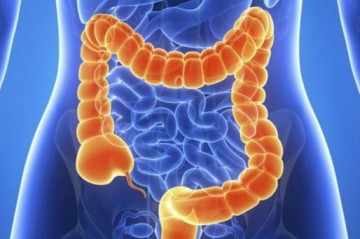 5 Makanan Sederhana Cegah Kanker Usus